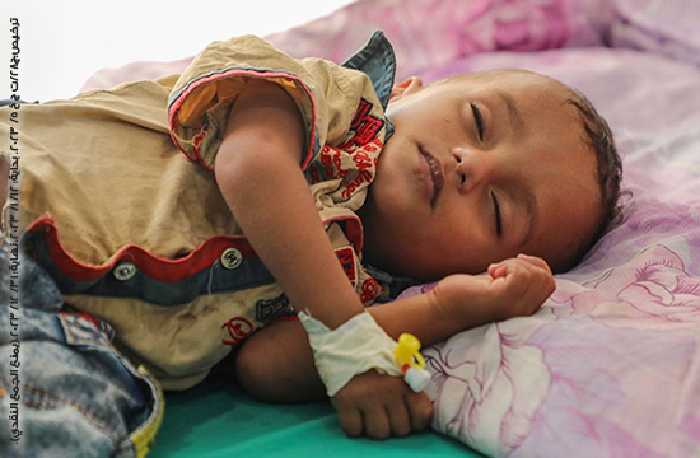 صورة توفير حليب الأطفال في اليمن