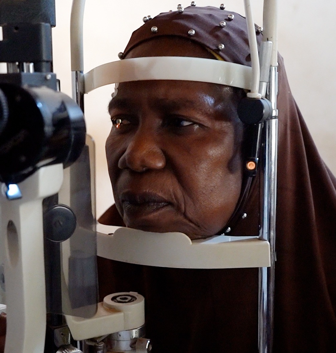 صورة عمليات العيون في إفريقيا