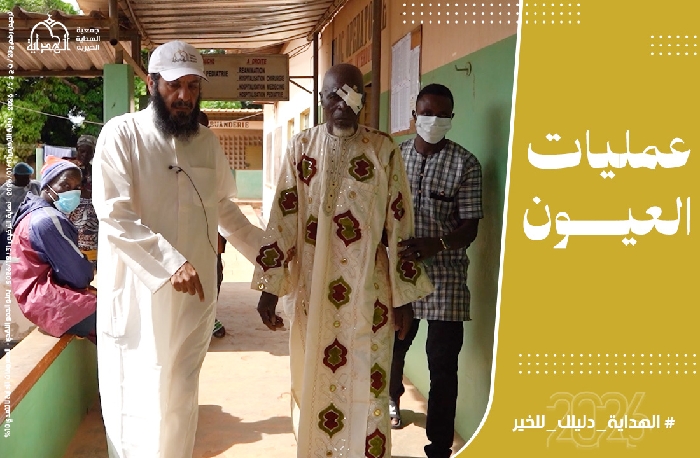 صورة عمليات جراحة العيون